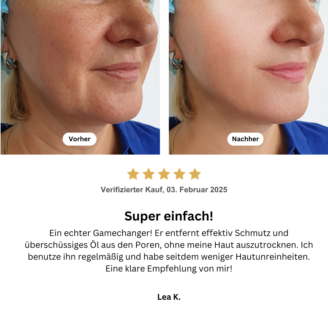 Hydroskin - Porenreiniger