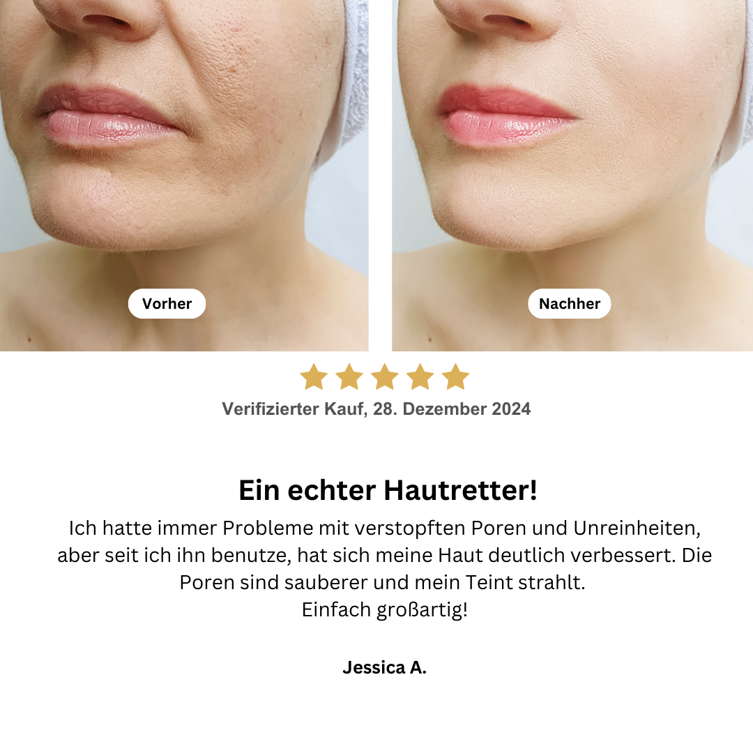 Hydroskin - Porenreiniger
