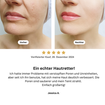 Hydroskin - Porenreiniger