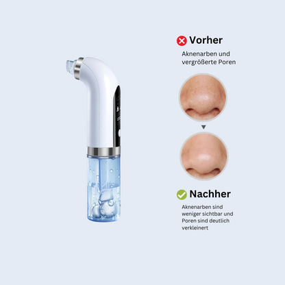 Hydroskin - Porenreiniger